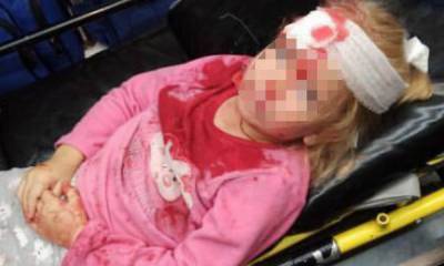 В Белоруссии во время акции протеста пострадала пятилетняя девочка