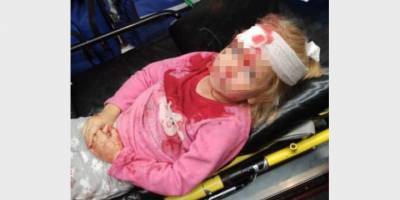 Белорусский ОМОН напал на семью с маленьким ребенком. Пятилетняя девочка попала в больницу