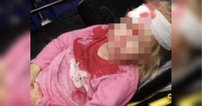 В Беларуси по вине ОМОНа пострадала 5-летняя девочка: выяснились шокирующие детали (фото)