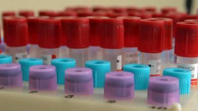 Бразильский штат Парана будет производить первую в мире российскую вакцину от COVID-19