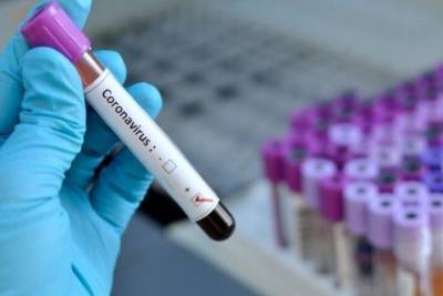 В Чувашии умер 66-й пациент с коронавирусом