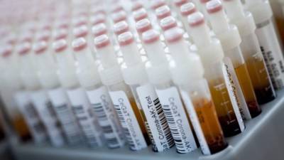 Заболеваемость растет: за сутки в Германии зарегистрировали почти 1500 новых случаев заражения коронавирусом