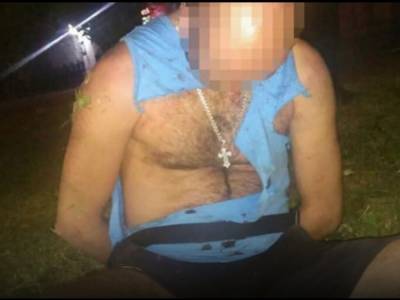 В Ивано-Франковске мужчине на улице неизвестный вонзил нож в шею