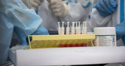У пяти сотрудников ЗАО "Содружество-Соя" выявили коронавирус