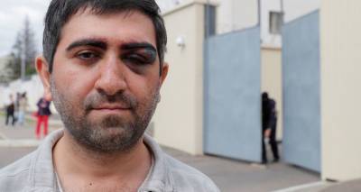Гражданин Армении был избит силовиками в ходе протестов в Минске