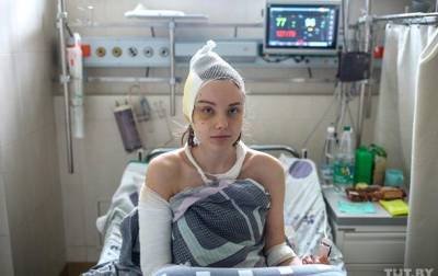 В больницах Минска находятся 150 пострадавших