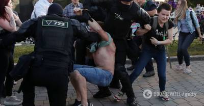 В сети показали травмы протестующих в Минске. Фото из больницы 18+ | Мир | OBOZREVATEL