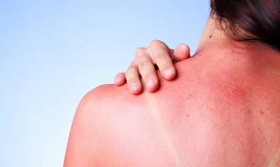 Опасность каждую секунду: открыт механизм возникновения рака кожи из-за солнца