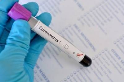В Запорожье в студенческом общежитии зафиксировали вспышку коронавируса