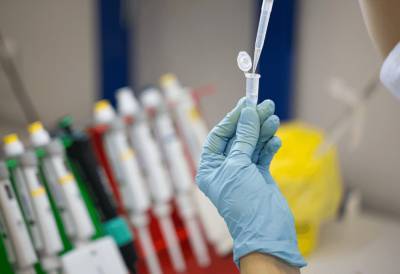 Производство вакцины от коронавируса стартовало в России