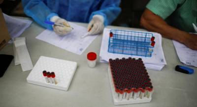 В мире зафиксировали более 21,5 миллиона случаев коронавируса