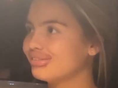 Девушка экспериментировала и «увеличила» себе губы: в Сети показали забавное видео