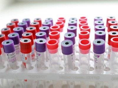 В Болгарии выявлено минимальное число случаев заражения коронавирусом за два месяца
