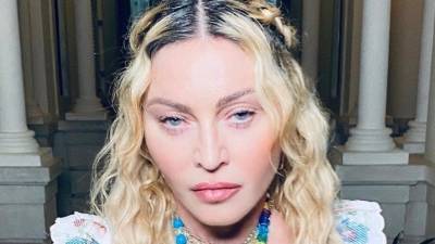 Поклонники попросили Мадонну перестать уродовать себя