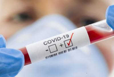 28 новых случаев коронавируса выявлено в 13 районах Ленобласти