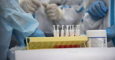 Калининградцы с симптомами ОРВИ смогут платно сдать тест на коронавирус