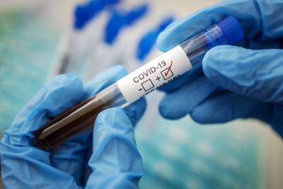 На Кубани подтвердили 84 новых случая инфицирования коронавирусом