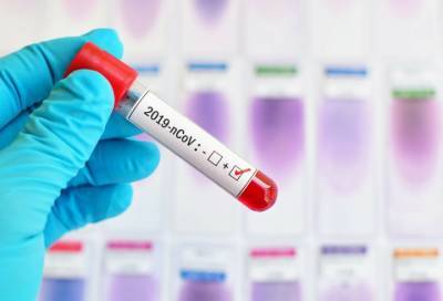 За последние сутки в Ленобласти выявили 26 новых случаев коронавируса
