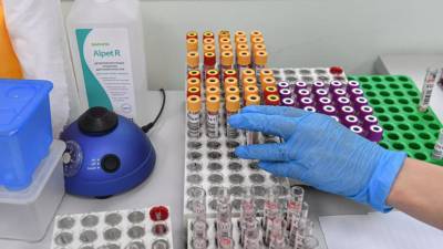 В России за сутки выявлено 4748 новых случаев коронавируса