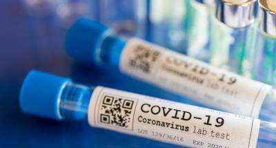 В Израиле выявляют коронавирус за считанные секунды