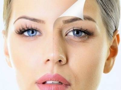 Медики назвали причины преждевременного появления «гусиных лапок» вокруг глаз