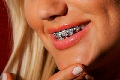 Популярность бриллиантов на зубах россиян объяснили их желанием хайпануть