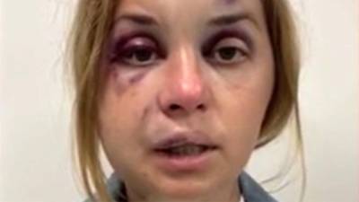 Безбилетник избил и пытался изнасиловать телеведущую в поезде Мариуполь-Киев