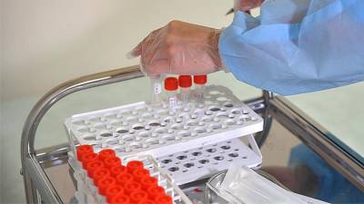 Более 28,7 млн тестов на коронавирус провели в России