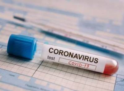 В Арцахе у двух граждан выявлена коронавирусная инфекция