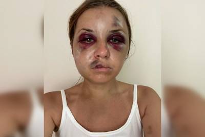 На Украине жестоко избили телеведущую Анастасию Луговую