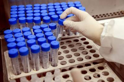 Ученые: антитела защищают от повторного заражения COVID-19 - Cursorinfo: главные новости Израиля