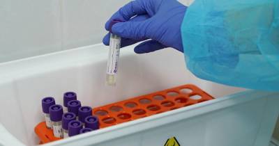 В России за сутки выявили 4 785 случаев коронавируса
