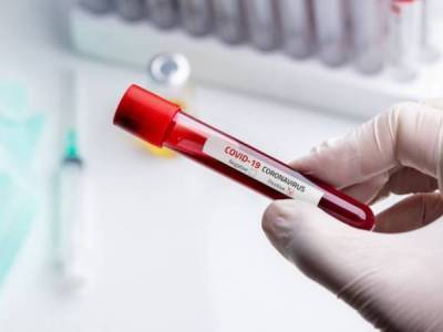 В Арцахе выявлено семь новых случаев заражения коронавирусом