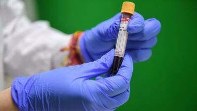 Более 33,8 млн тестов на коронавирус проведено в России