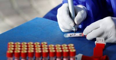 В Литве за сутки подтверждено 37 новых случаев коронавируса, умер еще один человек