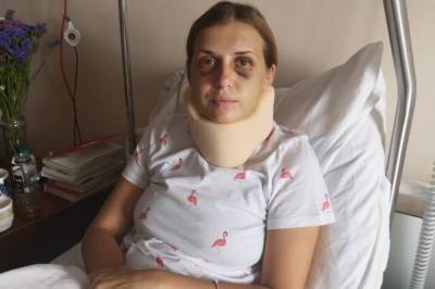 Жестоко избитой в поезде Мариуполь-Киев девушке предлагали 30 тыс. гривен за молчание