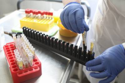Число проведенных в России тестов на коронавирус превысило 34 миллиона