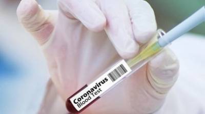 Еще у 50 жителей Пензенской области подтвержден коронавирус