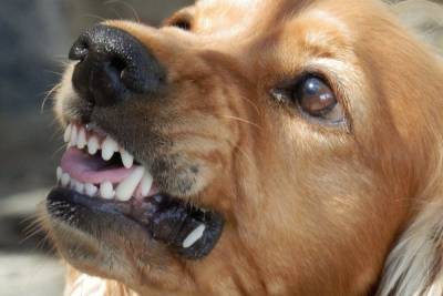 Смоленске на домашнюю собаку и ее хозяйку напал агрессивный дворовый пес