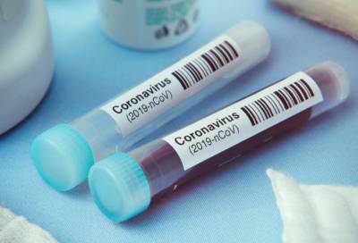 Новые 28 случаев коронавируса выявили в восьми районах Ленобласти