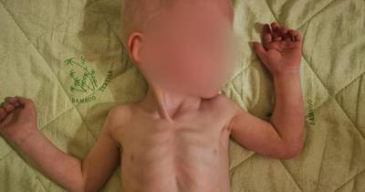 Между жизнью и смертью: мальчика довели до истощения в детдоме в Крыму
