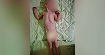 Прокуратура проверит сообщения об истощенном ребенке в детдоме в Крыму