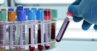 В США временно разрешили лечить коронавирус плазмой крови