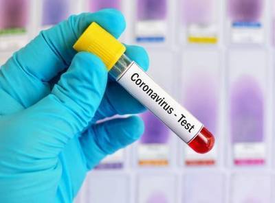 Абсурд по понедельникам: Власти Армении заявили лишь о 33 новых случаях заражения коронавирусом