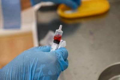 В Волгоградской области раньше обычного стартует вакцинация от гриппа
