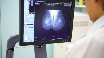 Одна доза облучения заменит недели радиотерапии рака груди