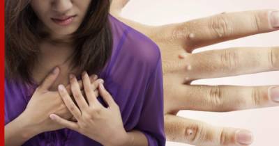На коже нашли неожиданные признаки серьезных проблем с сердцем