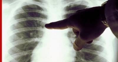 Раскрыта главная причина появления рака легких у некурящих