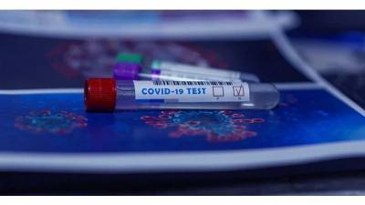 Минздрав оценил риск повторного заражения коронавирусом