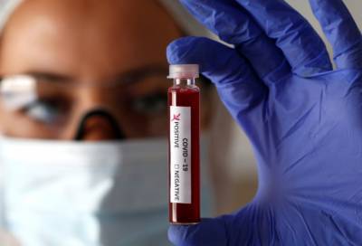 За сутки в России нашли 4711 новых случаев коронавируса